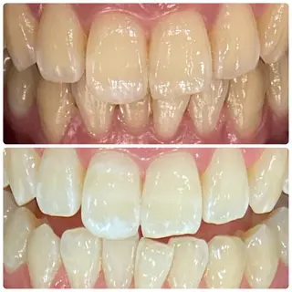 PLATINUM Beauty 横浜店所属・ホワイトニングルーム 横浜店のその他イメージ