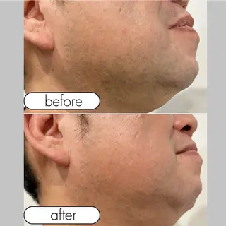 メンズ ＆MoRe.yasu アンドモアヤスのエステ・リラクイメージ