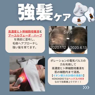 NONOKEKE ノノケケのエステ・リラクイメージ