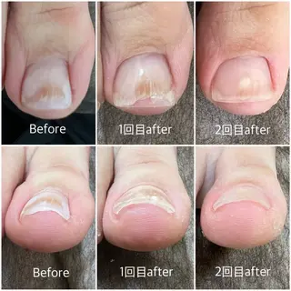 ネイル Beauty salon-seren-所属・ビューティーサロン serenの眉毛・アイブロウイメージ