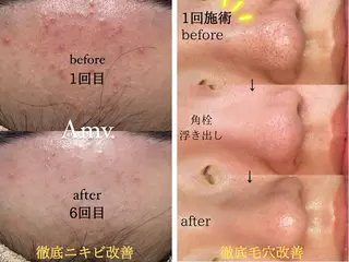 Amv. mananoのエステ・リラクイメージ