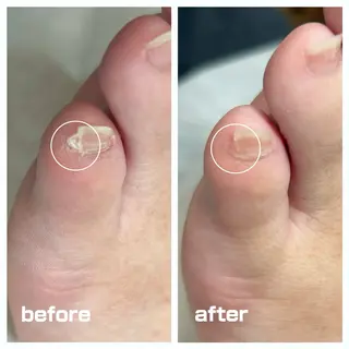 巻き爪フットケアサロンKotori所属・フットケアサロン Kotoriのその他イメージ