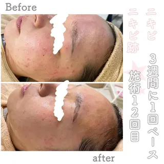 ショート カラー パーマ ヘアアレンジ メンズ キッズ マツエク・マツパ アイブロウ ニキビ&跡改善サロン オーナー光木のエステ・リラクイメージ