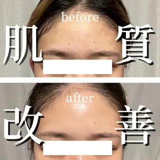 小顔サロン AMYONのエステ・リラクイメージ