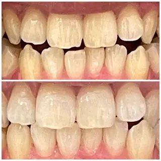 アイブロウ ダイヤモンドホワイトニング渋谷所属・DIAMOND BEAUYのその他イメージ