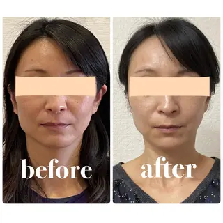 Cream 福井のエステ・リラクイメージ