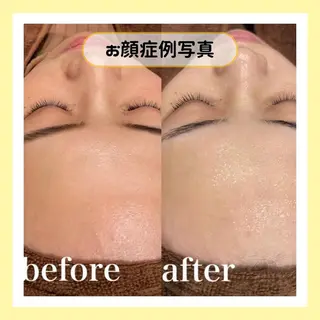 金山/脱毛/美肌 ULULUのエステ・リラクイメージ