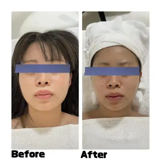 プライベートサロンmoyo所属・プライベートサロン moyoのエステ・リラクイメージ