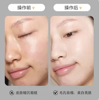 パーマ aliaハイフ&水光ジェットサロン所属・aliaハーブ水光店 エステティシャン募集のエステ・リラクイメージ