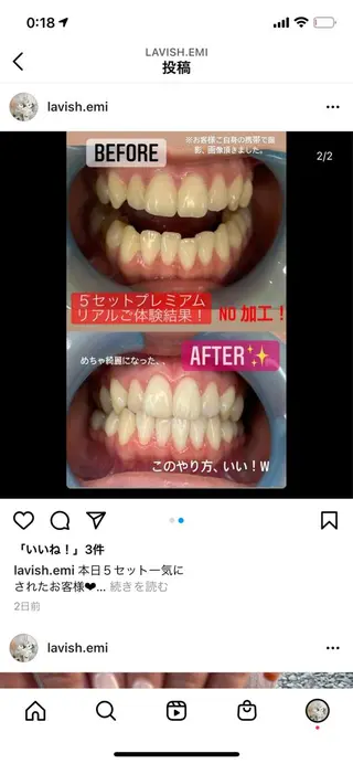 LAVISH nail salonのネイルデザイン