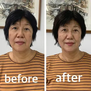 小顔と ヘッドスパのお店のエステ・リラクイメージ