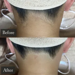 脱毛専門サロン BELFINE恵比寿のエステ・リラクイメージ