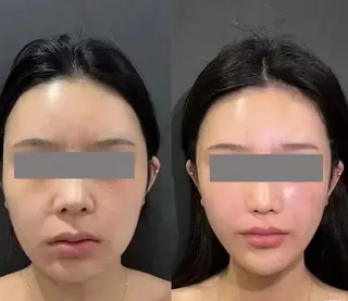 aliaハイフ&水光ジェットサロン所属・aliaハーブ水光店 エステティシャン募集のエステ・リラクイメージ