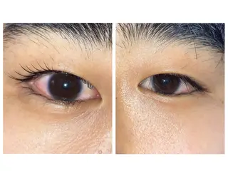 メンズ マツエク・マツパ TOPアイリスト ふたつぎちさとのマツエク・マツパデザイン