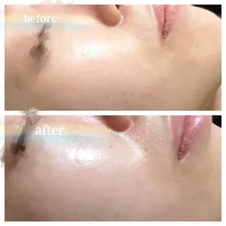 🅖🅤🅩🅔🅛 salonのエステ・リラクイメージ