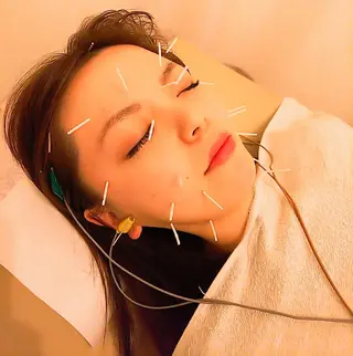 むくみたるみ専門☆ 美容鍼・小顔矯正のエステ・リラクイメージ