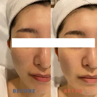 エステと焼き菓子 レモンバームソワンのエステ・リラクイメージ