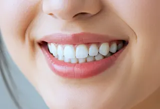 セルフホワイトニング　エクシアたまプラーザ店所属・セルフホワイトニング エクシアたまプラーザのその他イメージ