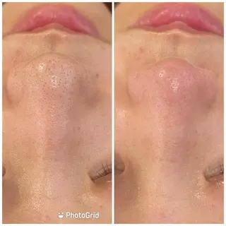 💚THE BALM 金子💚✨のエステ・リラクイメージ