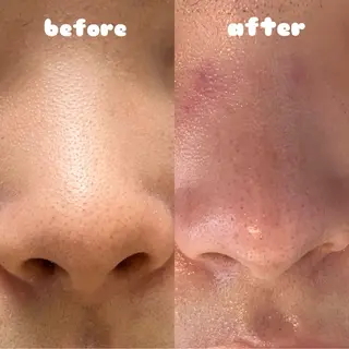 リンパ×ハーブ蒸し TIARA.烏丸三条のエステ・リラクイメージ