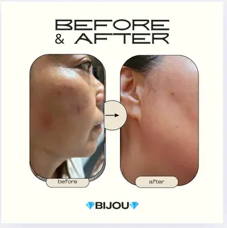 BIJOU八井 美加のエステ・リラクイメージ