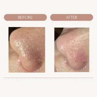 肌質改善✨️DeIm 岩根朋美のエステ・リラクイメージ