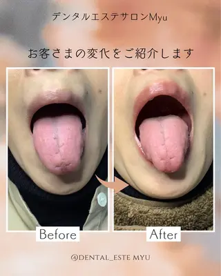 Myu所属・Suzuki Yumiのエステ・リラクイメージ