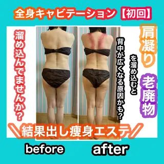 痩身/脱毛/ネイル HARUKAのエステ・リラクイメージ