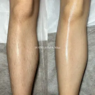 HOTEL&PARK Mikuワックス脱毛のエステ・リラクイメージ