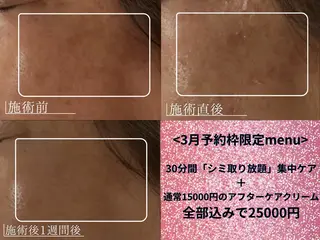 サロンマミ MAMIのエステ・リラクイメージ