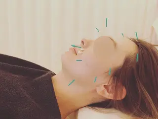 妙蓮寺ゆう鍼灸院所属・太田祐志 /中医美容鍼のエステ・リラクイメージ