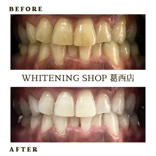 メンズ ホワイトニング ショップ葛西店のその他イメージ