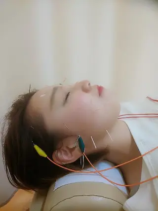 お顔のむくみたるみ 専門☆美容鍼小顔矯正のエステ・リラクイメージ