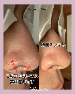 毛穴専門サロン Hanabiのエステ・リラクイメージ