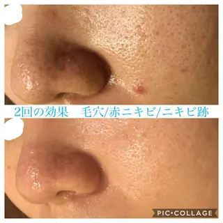 ロング カラー パーマ ヘアアレンジ キッズ ネイル マツエク・マツパ Ensor Clair所属・EnsorClair 代表　野口真央のエステ・リラクイメージ