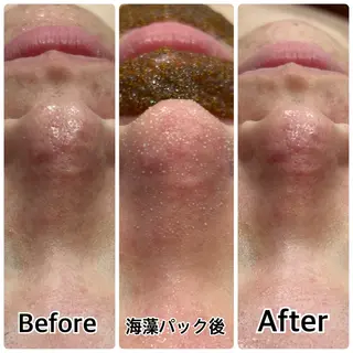 林 陽向のエステ・リラクイメージ