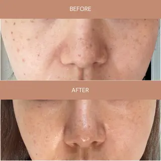 肌質改善エステ chiffonのエステ・リラクイメージ