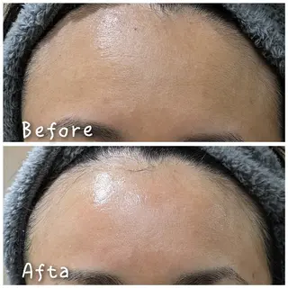 結果が出るスキンケア 肌質改善/まつパのエステ・リラクイメージ