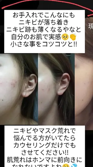 メナードフェイシャルサロン深井清水店所属・吉田 茜のエステ・リラクイメージ