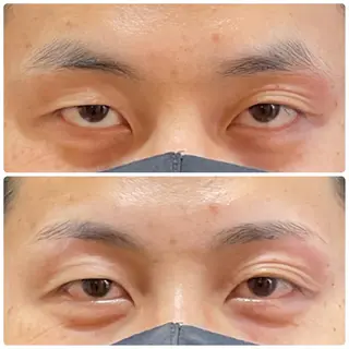 アイブロウ まゆはだ　メンズ眉毛＆フェイシャルサロン所属・まゆはだ　メンズ眉毛 ＆フェイシャルサロンの眉毛・アイブロウイメージ