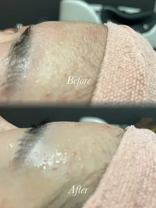 🫧美しい素肌へ🫧 今成柚乃のその他イメージ