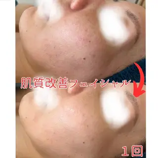 小顔コルギ&肌質改善 の専門店LIBREのエステ・リラクイメージ