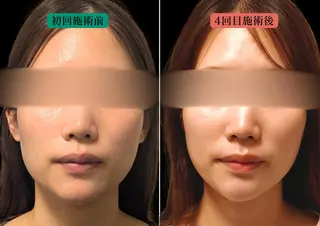 美容とカラダの鍼灸 サロン やなけんのエステ・リラクイメージ