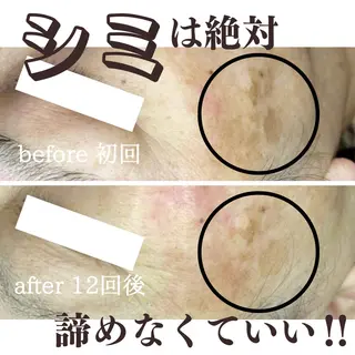 最新シミケアLily de pearlのエステ・リラクイメージ