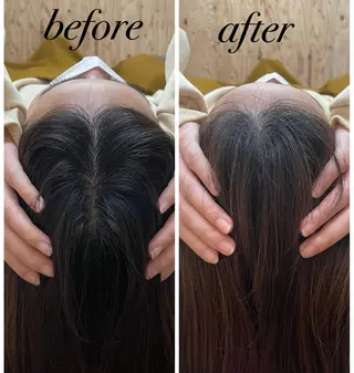 ate'所属・個室ドライヘッドスパ 🍃moriのエステ・リラクイメージ