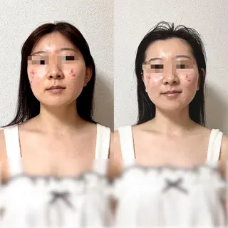 Hi, I am 1 PARAFUSE.所属・カラダとココロ 癒されほっと一息のエステ・リラクイメージ