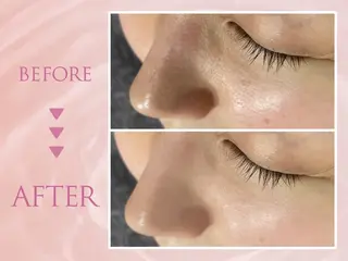 韓国肌管理専門店 Clear Labo クリアラボ 上野 【毛穴洗浄/ハイドラ/ピーリング】所属・Clear Lab 上野店のエステ・リラクイメージ