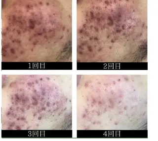 メンズ beautycare所属・Beauty careのエステ・リラクイメージ