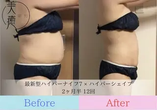 美癒 ハイパーナイフ&アロマ所属・美癒 池袋東口店のエステ・リラクイメージ