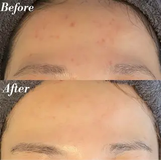 Belle原宿所属・佐藤 加奈のエステ・リラクイメージ